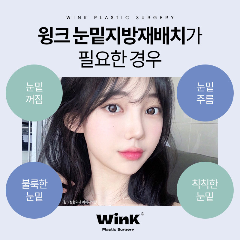 윙크성형외과 눈밑지방재배치 생기넘치고 어려보이게 관련 이미지 5