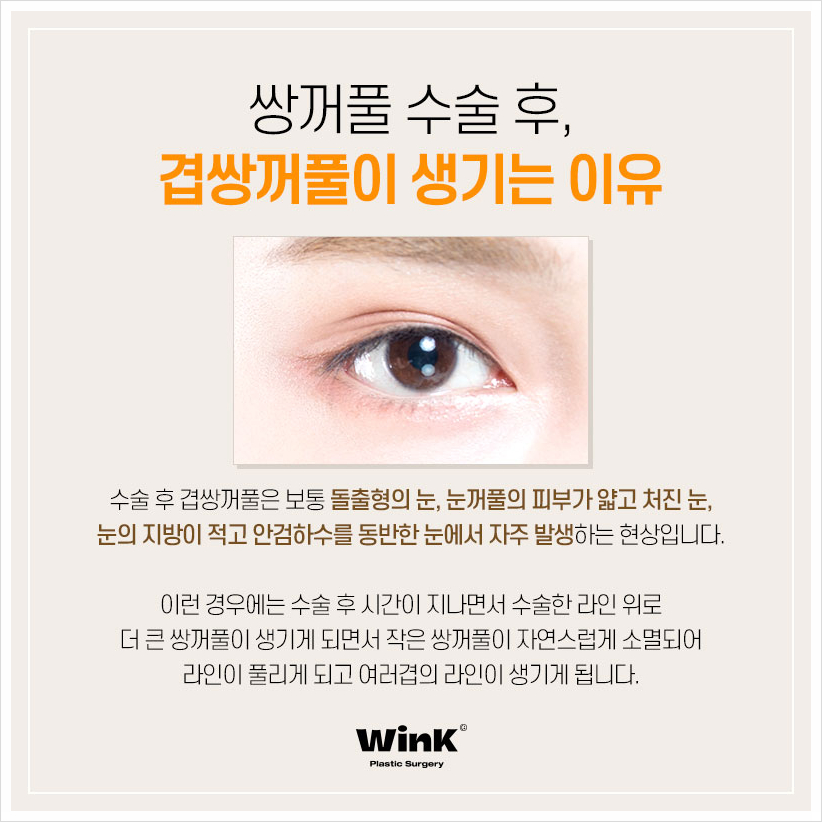 Multiple Eyelids, Double Eyelid Creases, Double Folded Eyelids, Eyelid Creases, Wink Plastic Surgery, Double Eyelids, Double Eyelid Revision Cost image 2
