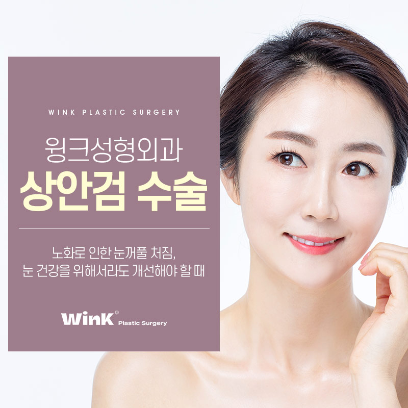 중년눈성형 상안검수술을 알아보자. 관련 이미지 1