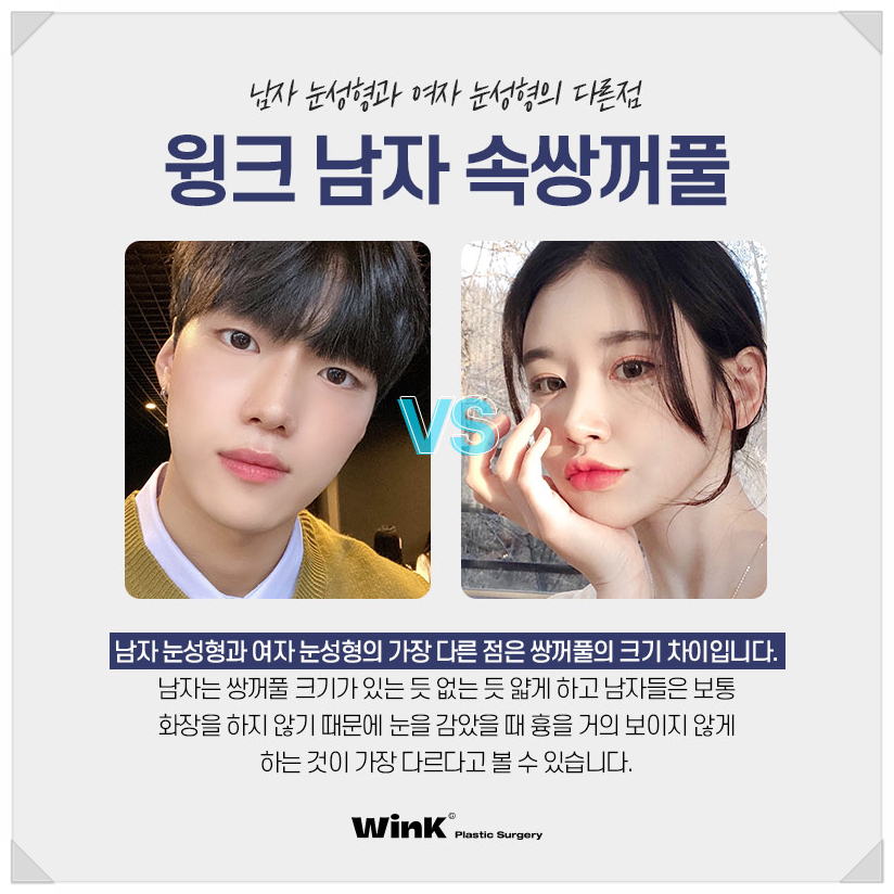 신사남자눈성형전후 남자쌍꺼풀수술 윙크성형외과 남자쌍수 속쌍꺼풀수술 관련 이미지 5