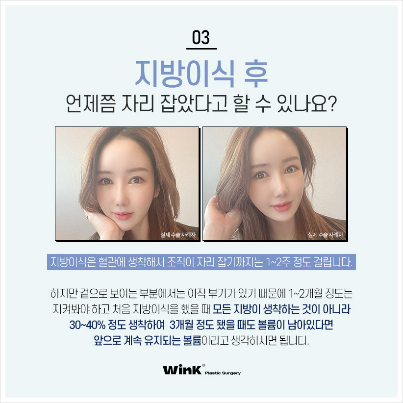 꺼진이마 납작이마 고민이라면? 윙크성형외과 이마볼륨 신사이마지방이식 이마지방이식전후 관련 이미지 4