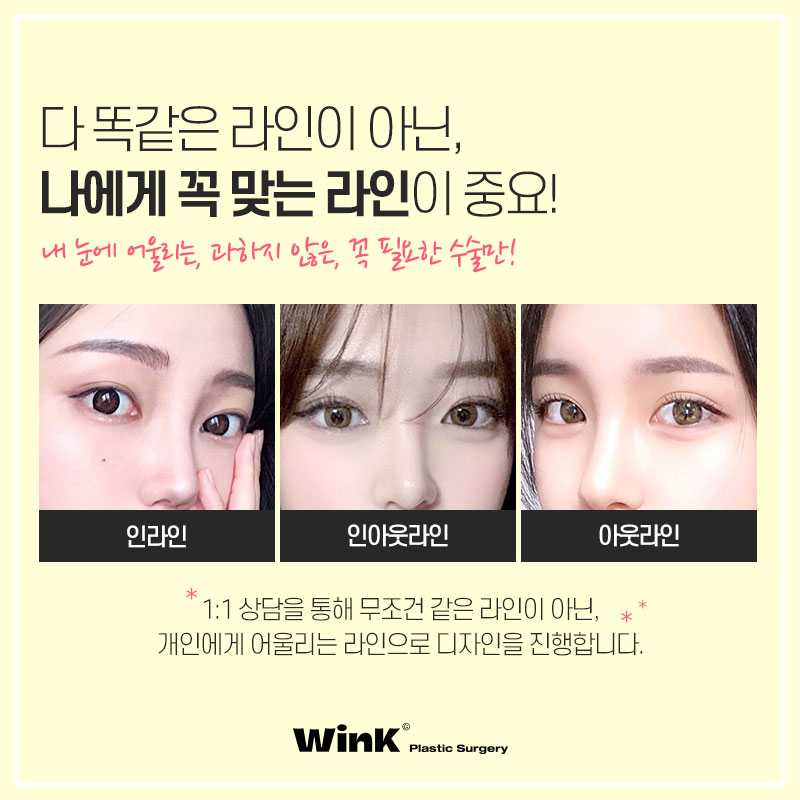 윙크성형외과 자연유착쌍꺼풀후기 쌍수잘하는곳 관련 이미지 4