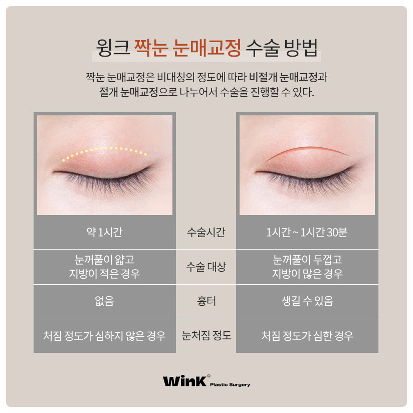 짝눈눈매교정술 잘하는곳? 비대칭짝눈교정 짝눈쌍수 잘하는 윙크성형외과 눈매교정짝눈! 관련 이미지 6