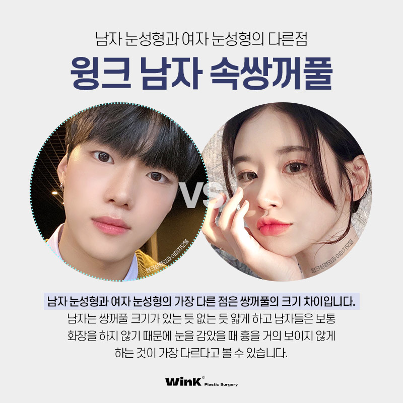 윙크성형외과만의 남자 눈성형으로 자연스럽게 호감형 이미지로 개선! 관련 이미지 5
