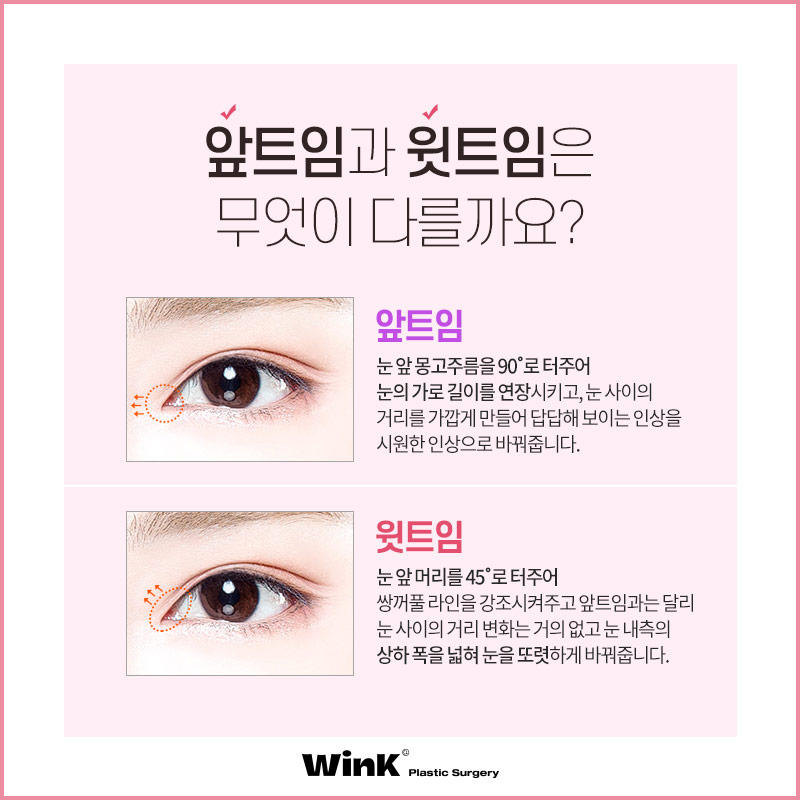 Wink Canthoplasty That Gently Lifts for a More Defined, Clear Eye Shape! image 3