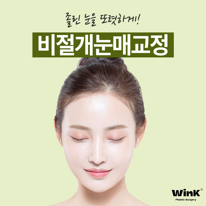 Improvement for Sleepy Eyes? Get Clear, Refreshing Eyes with Non-Incisional Eye Correction at Wink Plastic Surgery! image 1