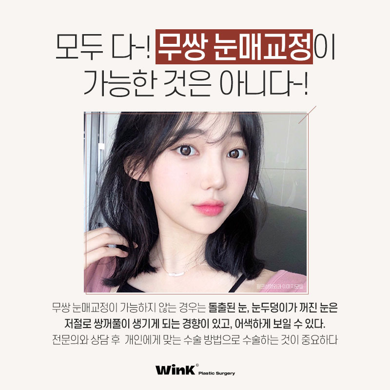 윙크 무쌍 눈매교정으로 쌍꺼풀 라인 없이  또렷한 눈매! 관련 이미지 4