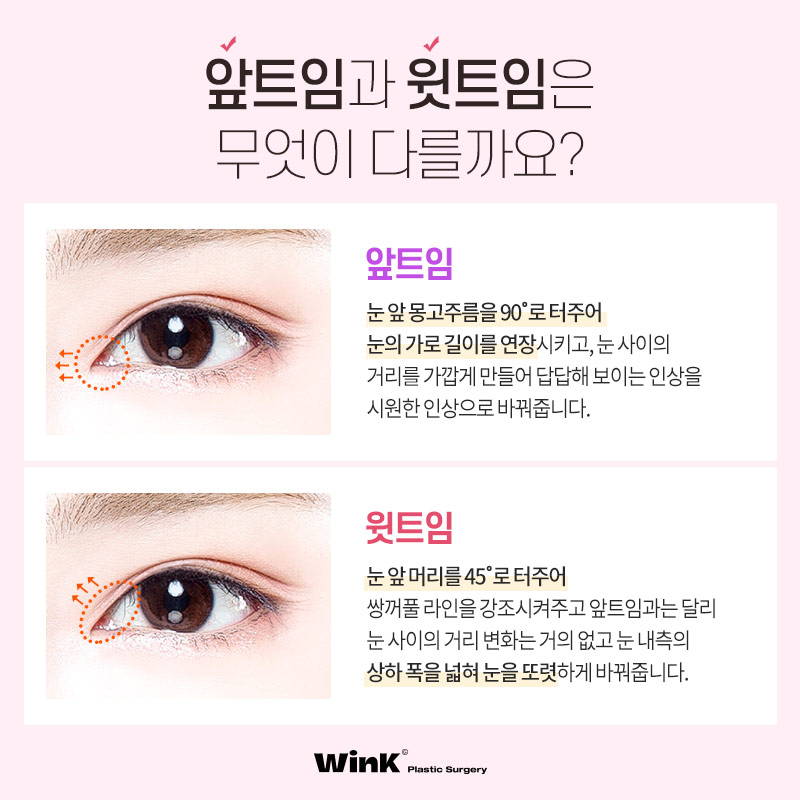Subtly Enhancing the Eyes with Wink Plastic Surgery’s Upper Epicanthoplasty! image 4