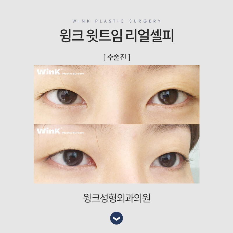 윗트임에 대해 알아보겠습니다. 관련 이미지 6