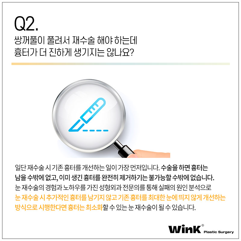윙크성형외과에서 알려드리는 눈성형의 모든것! 관련 이미지 4