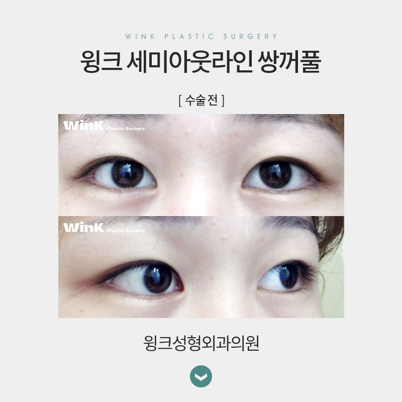 세미아웃 연예인 누가 있을까? 관련 이미지 7
