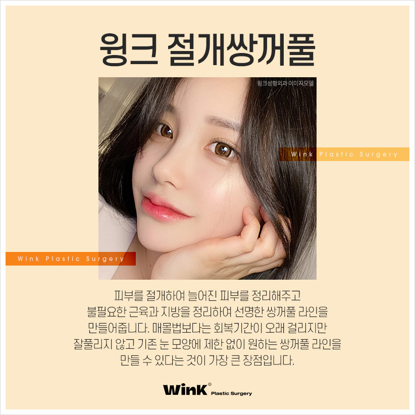쌍수잘하는곳? 윙크성형외과 절개쌍꺼풀 쌍수절개붓기 관련 이미지 2