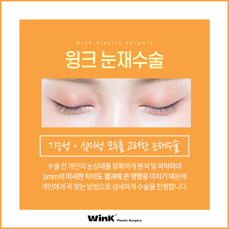 Wink’s Upper Blepharoplasty Revision Surgery, Considering Both Function and Aesthetics image 2