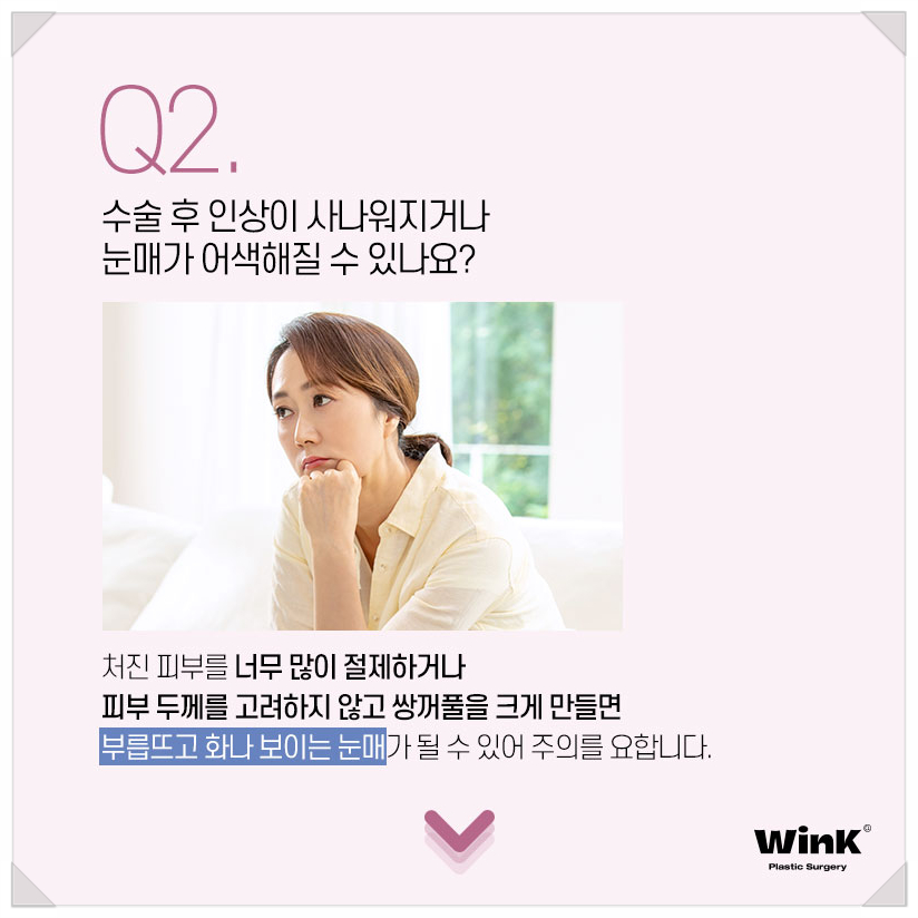 처진눈꺼풀수술 눈처짐수술 알아본다면 윙크성형외과 상안검수술 상안검수술회복기간 관련 이미지 4