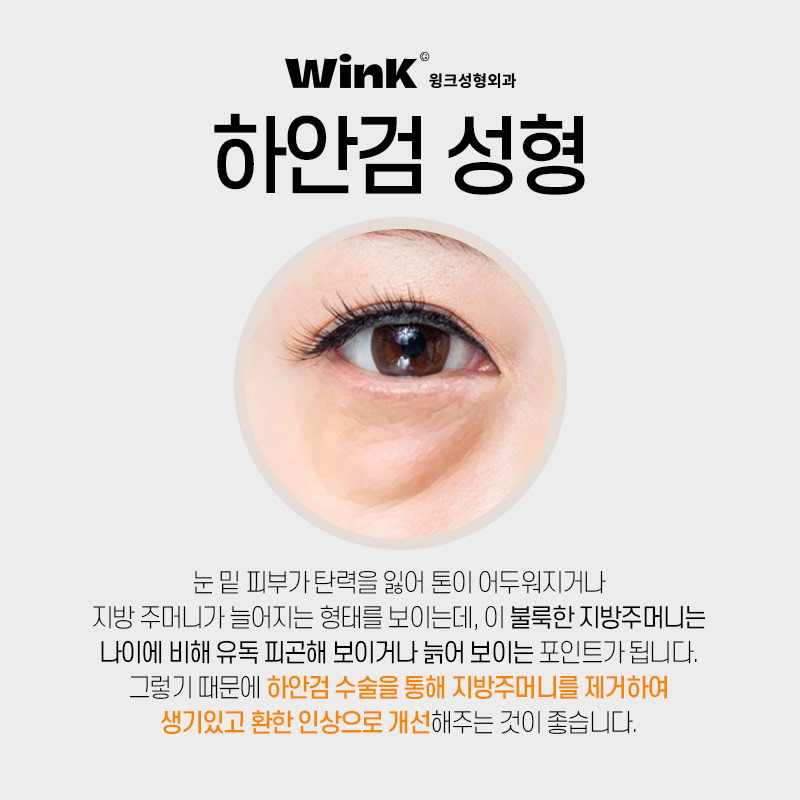 Lower Eyelid Surgery at Wink Plastic Surgery for Bulging, Wrinkled Under-Eyes image 2