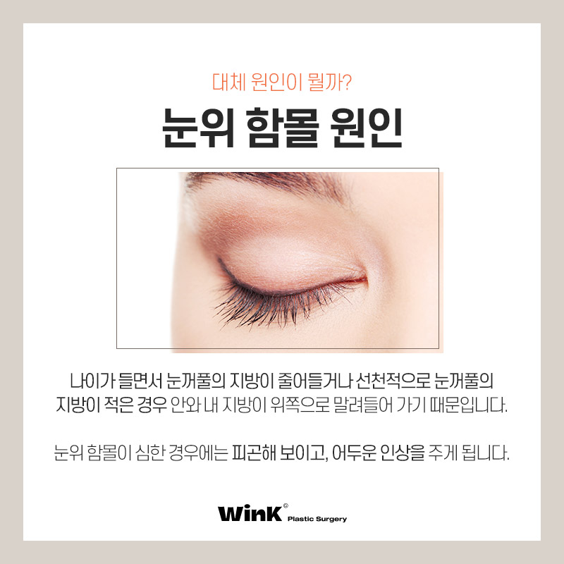Lift Tired-Looking Eyelids with Upper Eyelid Fat Repositioning at Wink Plastic Surgery! image 3