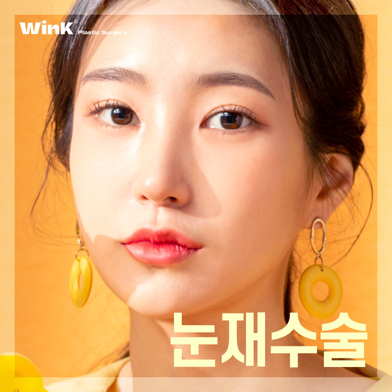 마지막 눈재수술을 위한 선택! 윙크성형외과 눈재수술 관련 이미지 1