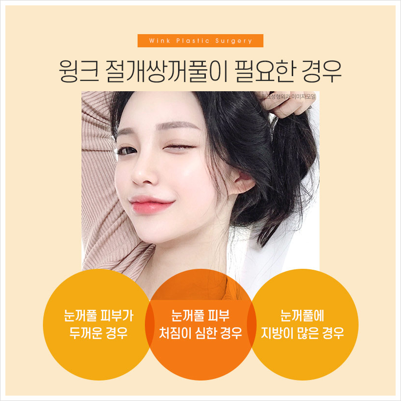 쌍수잘하는곳? 윙크성형외과 절개쌍꺼풀 쌍수절개붓기 관련 이미지 6