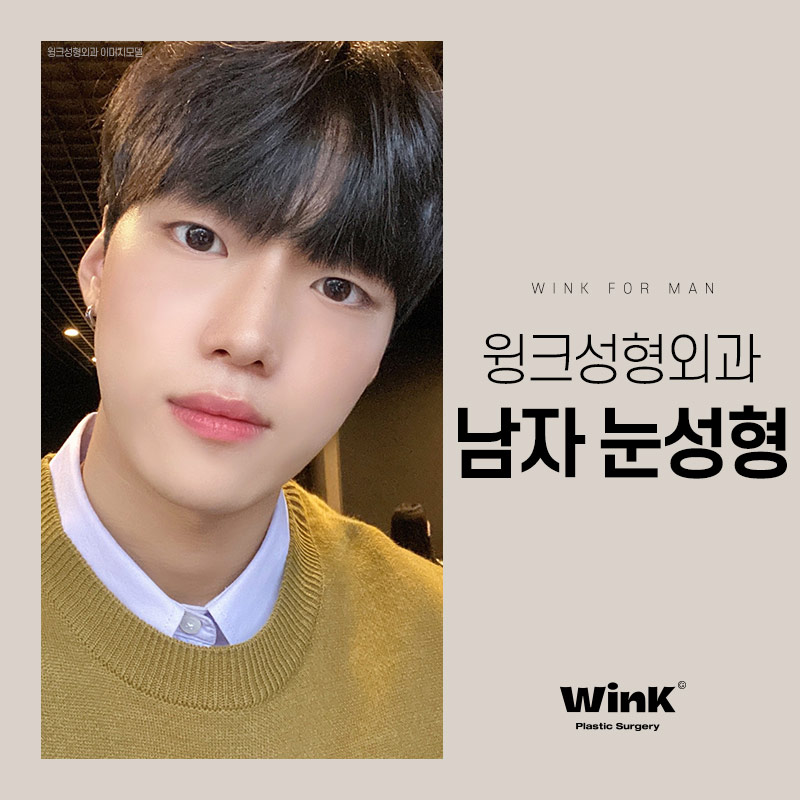 신사역 윙크성형외과 신사남자눈성형 남자쌍수후기 관련 이미지 5