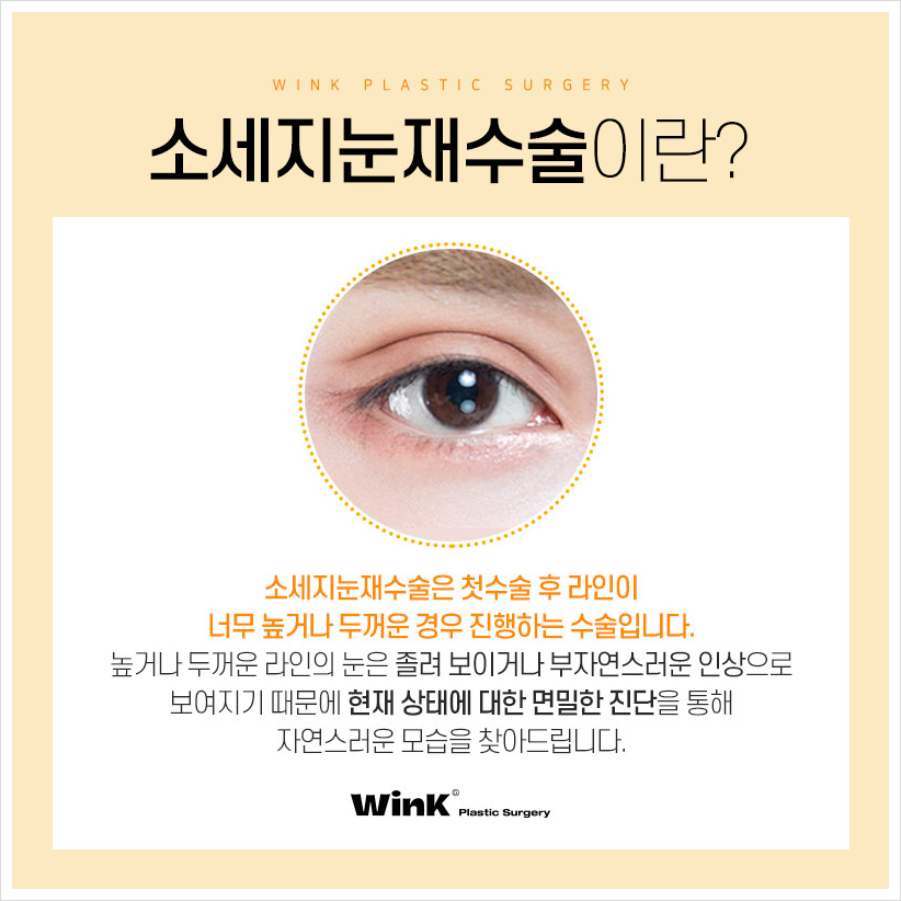 Sausage Eyes After Double Eyelid Surgery: If You’re Concerned About a Bulky Double Eyelid, Wink Plastic Surgery’s Double Eyelid Line Lowering and Sausage Eye Revision Surgery Costs image 2