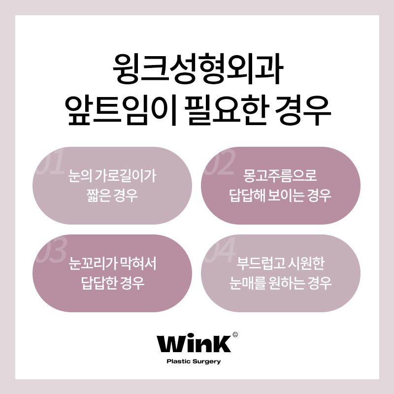 윙크 앞트임, 답답한 눈 앞머리를 시원하게 관련 이미지 6