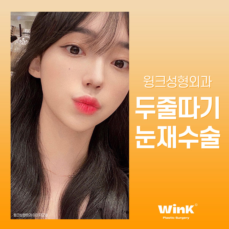 절제 없이 눈재수술 하고 싶다면? 윙크성형외과 두줄따기 눈재수술 관련 이미지 4