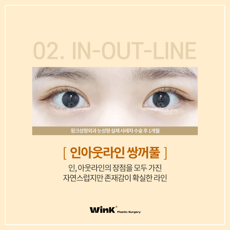 Let’s Learn About the Types of Double Eyelid Lines image 4