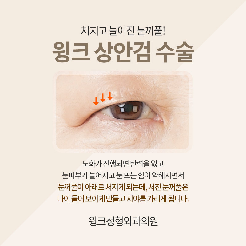 If You Want Upper Eyelid Surgery to Look Natural image 2