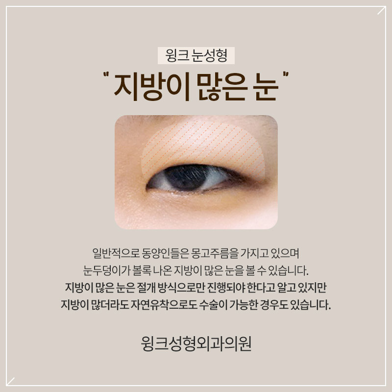 How Is Double Eyelid Surgery Performed on Eyes with a Lot of Fat? image 2