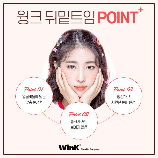 Wink canthoplasty and lower canthoplasty to overcome a cramped-looking eye shape! image 8