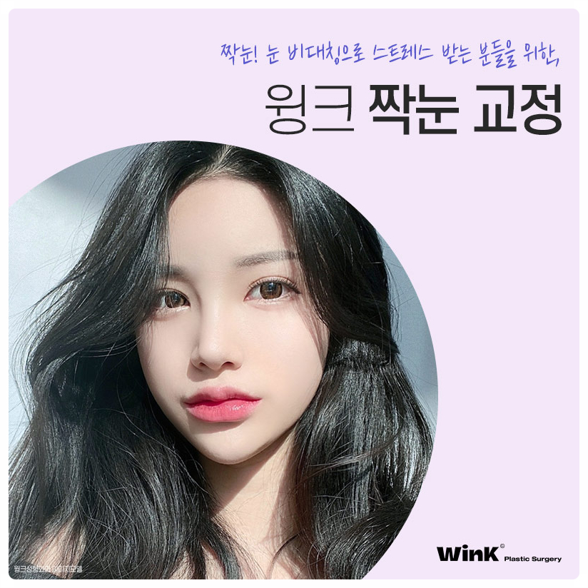 If You’re Looking Into Uneven Eye Correction Reviews: Wink Plastic Surgery, Uneven Eye Correction, Uneven Double Eyelid Surgery, Uneven Eyes image 5