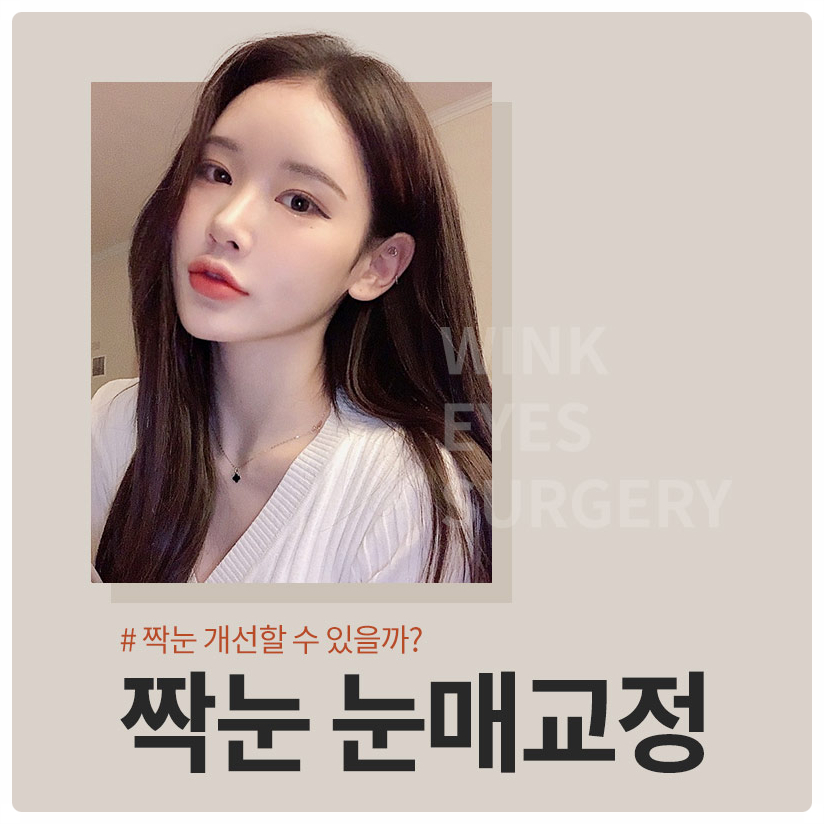 짝눈눈매교정술 잘하는곳? 비대칭짝눈교정 짝눈쌍수 잘하는 윙크성형외과 눈매교정짝눈! 관련 이미지 1