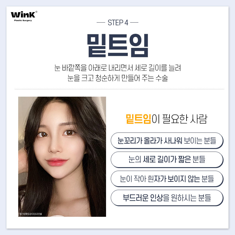 윙크성형외과에서 추천하는 눈 유형별 트임 성형? 관련 이미지 6