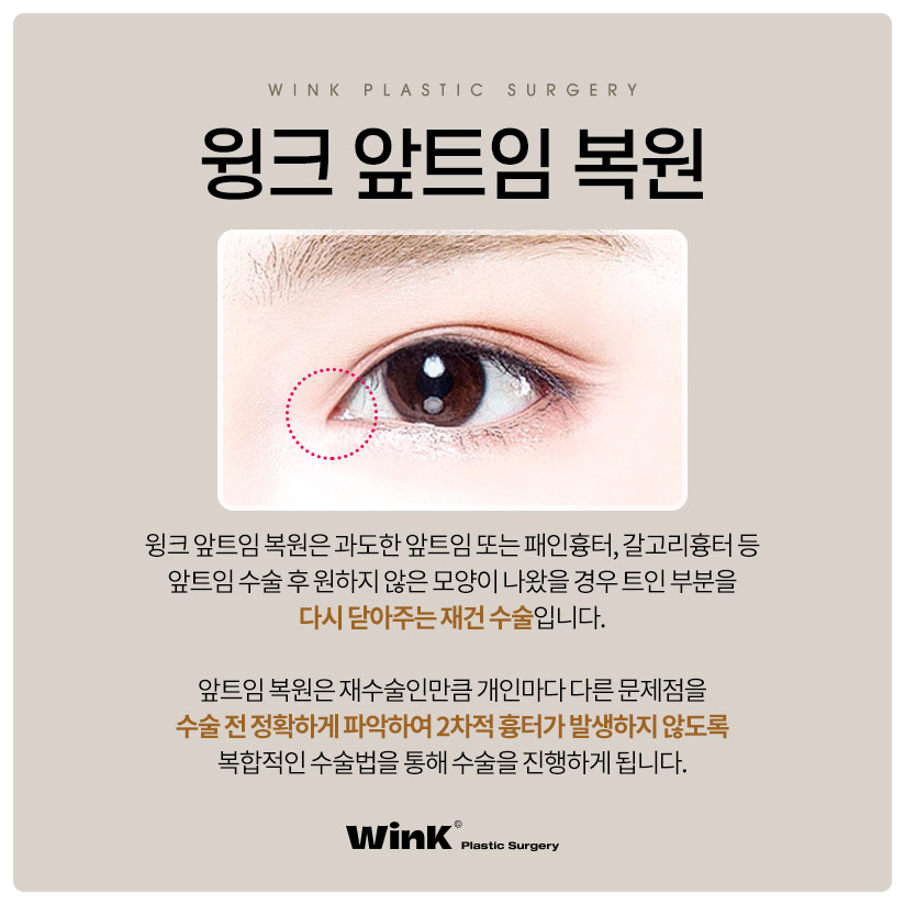 Epicanthoplasty Reconstruction: Recovery Period for Epicanthoplasty Restoration | Wink Plastic Surgery Epicanthoplasty Restoration Cost image 2