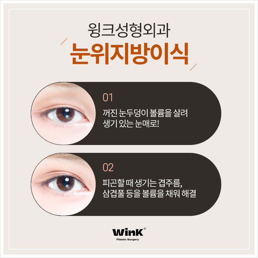 꺼진눈지방이식후기 눈두덩이지방이식 윙크성형외과 눈꺼풀꺼짐수술 관련 이미지 3