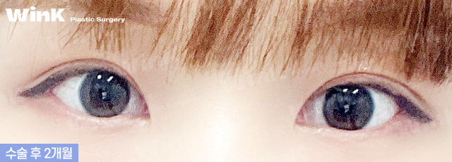 시원하면서도 부드러운 눈매로 만들어주는 듀얼트임 관련 이미지 5