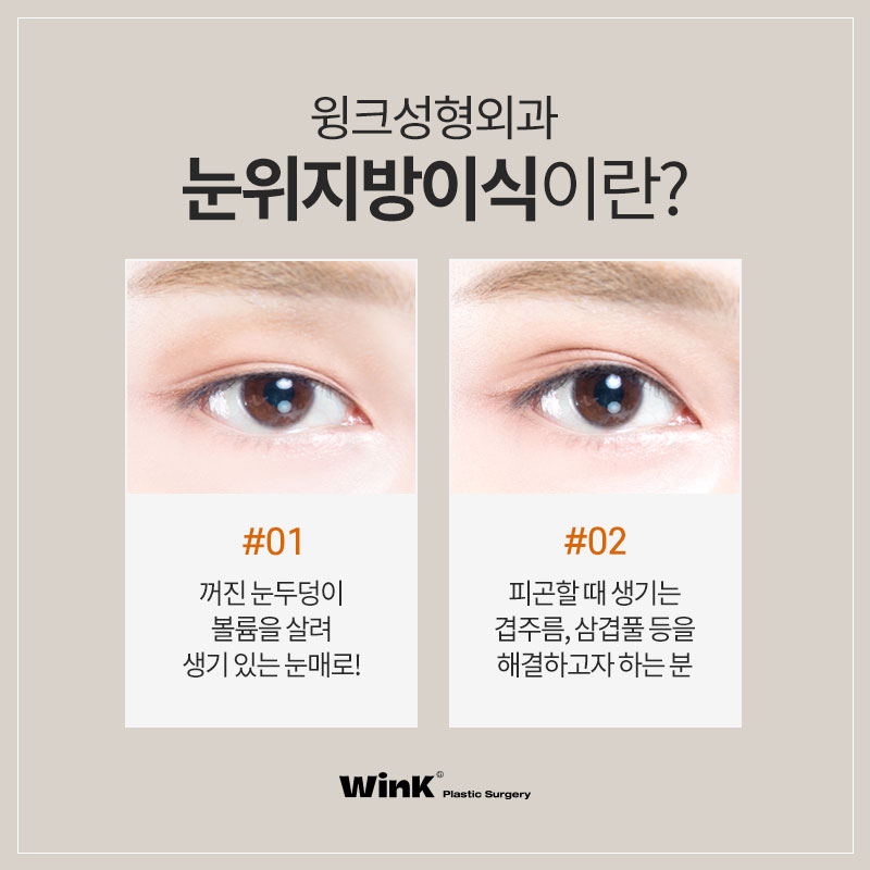 피곤해 보이는 눈은 이제 그만! 윙크 눈위지방이식으로 생기 있게! 관련 이미지 3