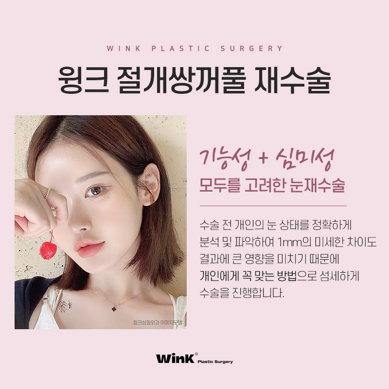 기능성과 심미성 모두 고려한 윙크성형외과 절개쌍꺼풀재수술! 관련 이미지 4