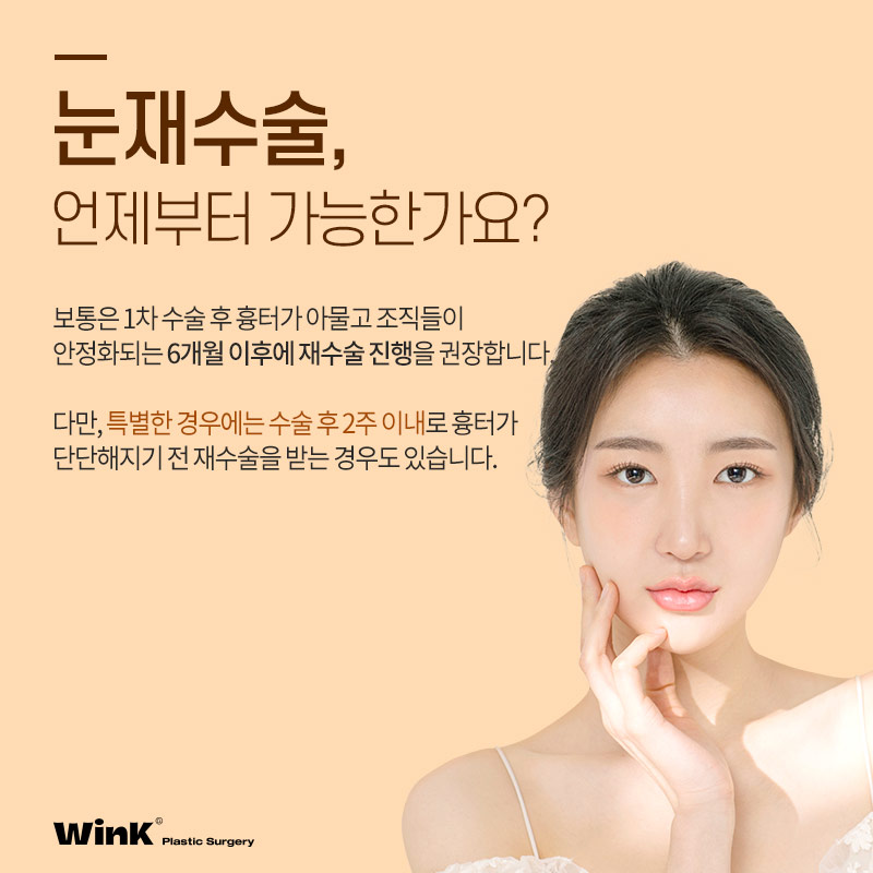 마지막 눈재수술을 위한 선택! 윙크성형외과 눈재수술 관련 이미지 4