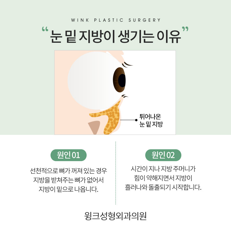 다크서클이 고민이라면, 윙크성형외과 눈밑지방재배치로 깔끔하게! 관련 이미지 3