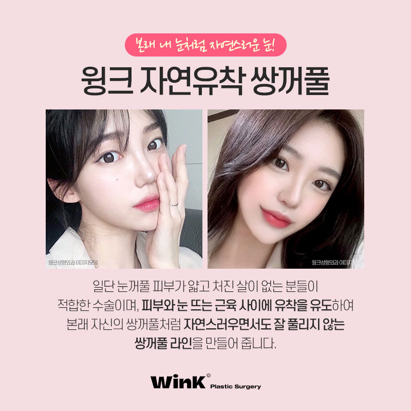 자연스럽게 예뻐지고 싶다면 윙크성형외과 자연유착쌍꺼풀! 관련 이미지 2