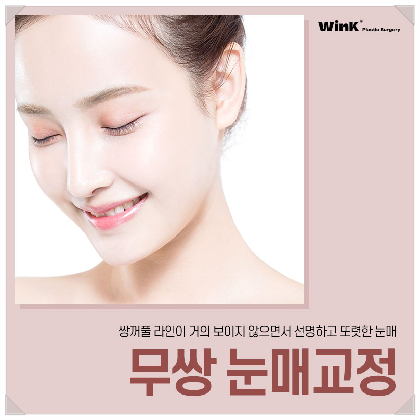 Epicanthoplasty-Free Ptosis Correction Surgery, Ptosis Surgery Without Double Eyelids, WINK Plastic Surgery, Ptosis Correction Surgery Before and After, Double Eyelid Ptosis Correction image 1
