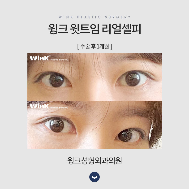 윗트임에 대해 알아보겠습니다. 관련 이미지 7