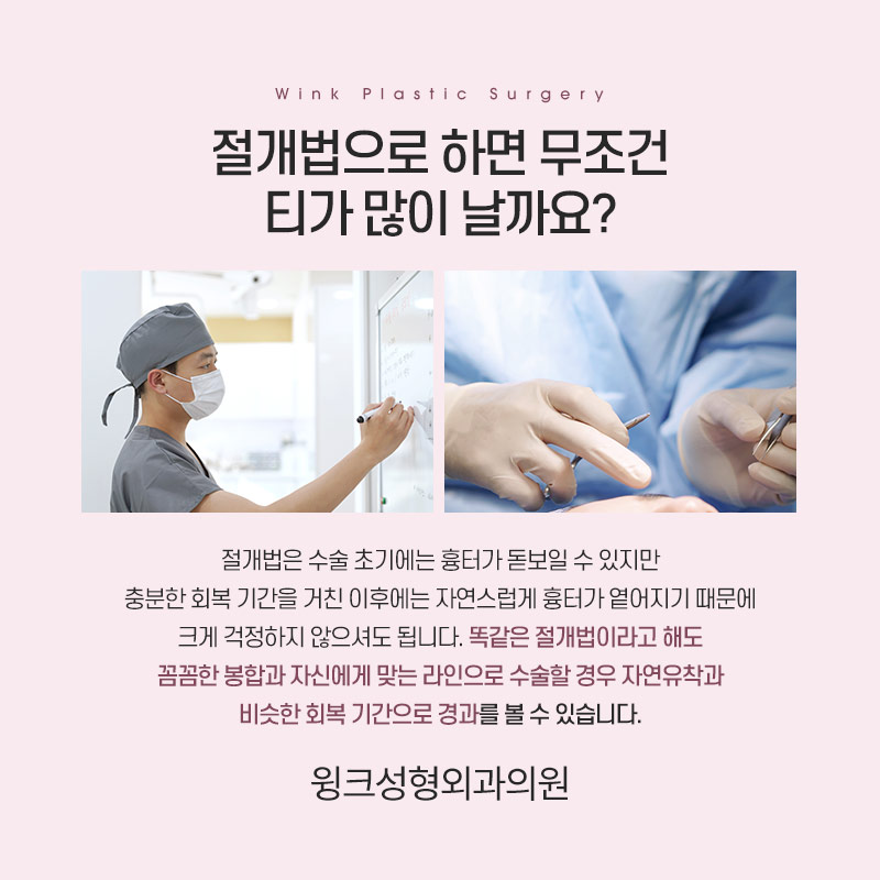 절개 쌍꺼풀 흉터에 대해 알아보겠습니다. 관련 이미지 4