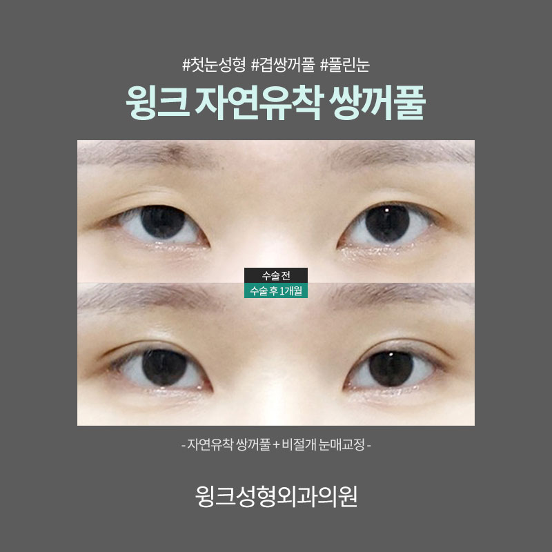 Resolve Double Eyelid Fold Creases with Natural Adhesion for a Clean, Defined Line! image 4