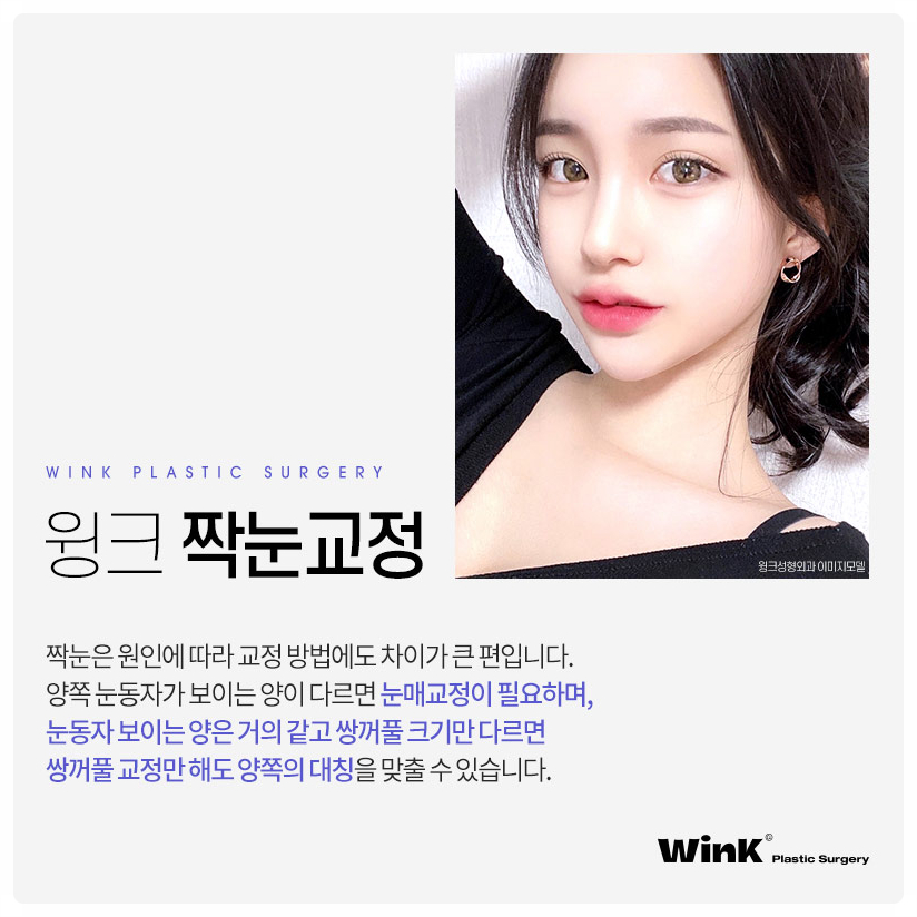 짝눈눈매교정 짝눈교정 눈매교정재수술 윙크성형외과에서 눈 비대칭 해결! 관련 이미지 3