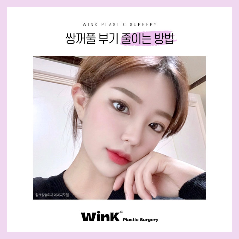 How to Reduce Swelling After Double Eyelid Surgery: Wink Plastic Surgery Explains! image 7