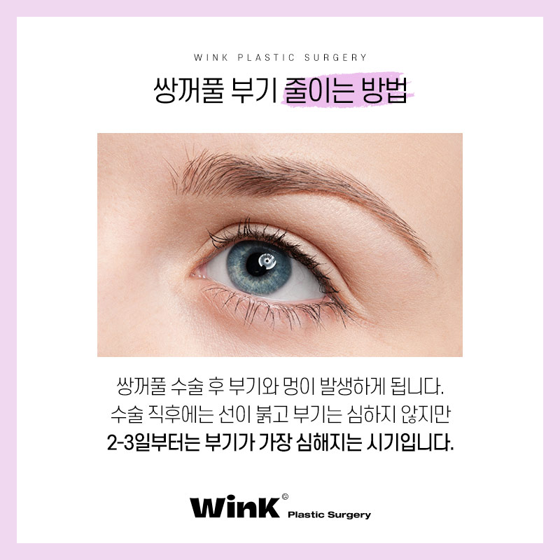 How to Reduce Swelling After Double Eyelid Surgery: Wink Plastic Surgery Explains! image 2