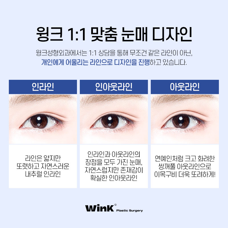 윙크성형외과 심플커브 자연유착 자연유착쌍꺼풀후기 자연스러운쌍수 쌍수자연유착 관련 이미지 5