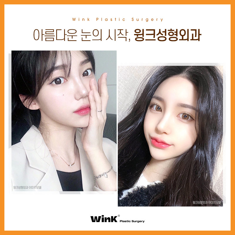쌍꺼풀재수술 쌍수재수술후기 윙크성형외과 신사눈재수술비용 관련 이미지 7